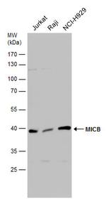 MICB Polyclonal Antibody
