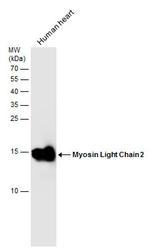 MYL2 Antibody in Western Blot (WB)