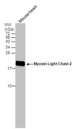 MYL2 Polyclonal Antibody
