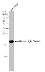 MYL2 Antibody in Western Blot (WB)