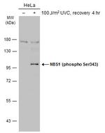 Phospho-NBS1 (Ser343) Antibody in Western Blot (WB)