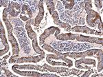NDUFS3 Antibody in Immunohistochemistry (Paraffin) (IHC (P))