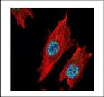 Nurr1 Antibody in Immunocytochemistry (ICC/IF)