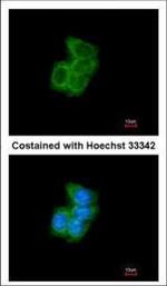 PDI Antibody in Immunocytochemistry (ICC/IF)