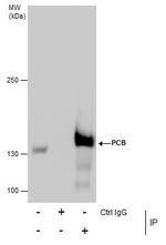 Pyruvate Carboxylase Antibody in Immunoprecipitation (IP)