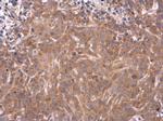 SERPINA5 Polyclonal Antibody