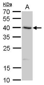 SERPINB8 Polyclonal Antibody