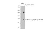 Phospho-PI3K p85/p55 (Tyr467, Tyr199) Antibody in Western Blot (WB)