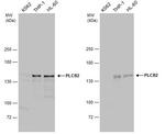PLCB2 Antibody in Western Blot (WB)
