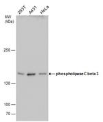 PLCB3 Antibody in Western Blot (WB)