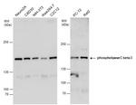 PLCB3 Antibody in Western Blot (WB)