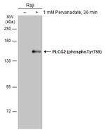 Phospho-PLCG2 (Tyr759) Antibody in Western Blot (WB)