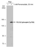 Phospho-PLCG2 (Tyr759) Antibody in Western Blot (WB)