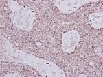 POLB Antibody in Immunohistochemistry (Paraffin) (IHC (P))