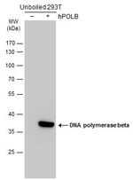 POLB Antibody in Western Blot (WB)