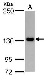 PPP1R3A Polyclonal Antibody