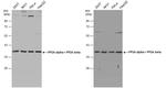 PP2A alpha/beta Antibody in Western Blot (WB)