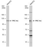 PKC mu Antibody in Western Blot (WB)
