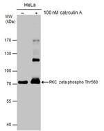 Phospho-PKC zeta (Thr560) Antibody in Western Blot (WB)