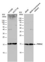 PRRG2 Antibody in Western Blot (WB)