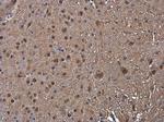 PSMB1 Antibody in Immunohistochemistry (Paraffin) (IHC (P))