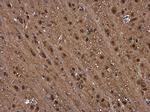 PSMB1 Antibody in Immunohistochemistry (Paraffin) (IHC (P))
