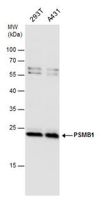 PSMB1 Antibody in Western Blot (WB)
