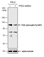 Phospho-FAK (Tyr407) Antibody in Western Blot (WB)