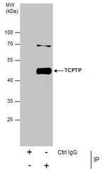 PTPN2 Antibody in Immunoprecipitation (IP)