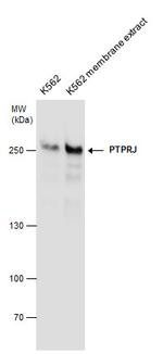 CD148 Antibody in Western Blot (WB)