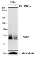 Paxillin Antibody in Western Blot (WB)