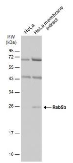 RAB5B Polyclonal Antibody