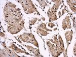 REST Polyclonal Antibody