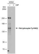 Phospho-RET (Tyr1062) Polyclonal Antibody