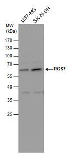 RGS7 Antibody in Western Blot (WB)