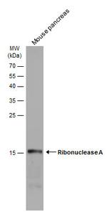 RNase1 Polyclonal Antibody