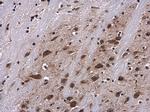 Phospho-S6 (Ser235) Antibody in Immunohistochemistry (Paraffin) (IHC (P))
