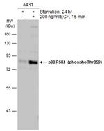 Phospho-RSK1 (Thr359) Antibody in Western Blot (WB)