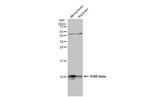S100B Antibody in Western Blot (WB)