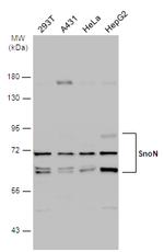 SnoN Antibody in Western Blot (WB)