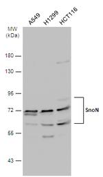 SnoN Antibody in Western Blot (WB)