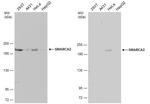 SMARCA2 Antibody in Western Blot (WB)