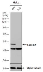 Fascin Antibody in Western Blot (WB)