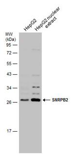 SNRPB2 Antibody in Western Blot (WB)