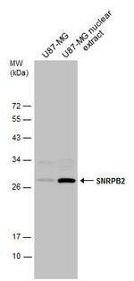 SNRPB2 Polyclonal Antibody