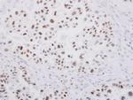 SP1 Antibody in Immunohistochemistry (Paraffin) (IHC (P))