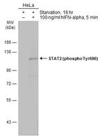 Phospho-STAT2 (Tyr690) Polyclonal Antibody