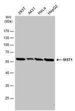 MSP Antibody in Western Blot (WB)