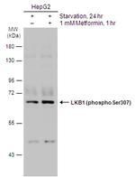 Phospho-LKB1 (Ser307) Antibody in Western Blot (WB)