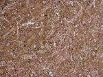 LKB1 Polyclonal Antibody
